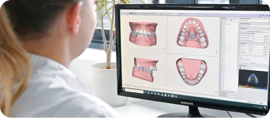 Cuestionario de nivel en flujo digital dental · Laboratorios protésicos