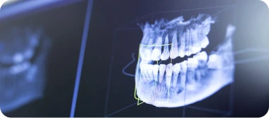 Cuestionario de nivel en flujo digital dental · Odontólogos