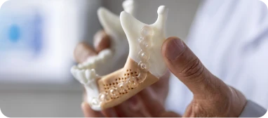 Cuestionario de nivel en Implantes Subperiósticos (ISP)